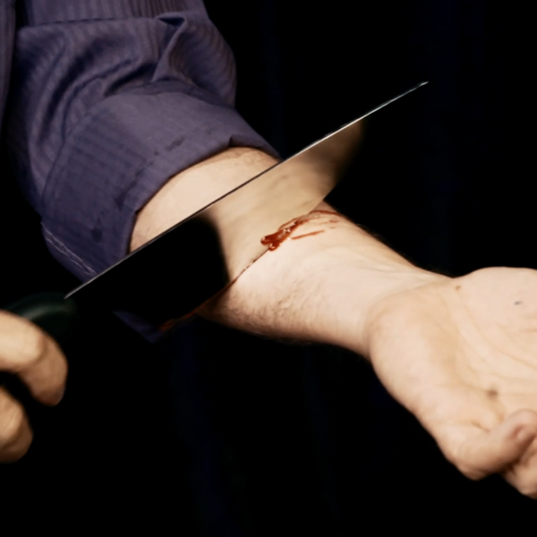 The Amazing Johnathan’s Knife Through Arm