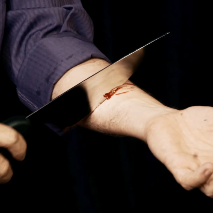 The Amazing Johnathan’s Knife Through Arm