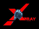 X-RAY by Rasmus Magic